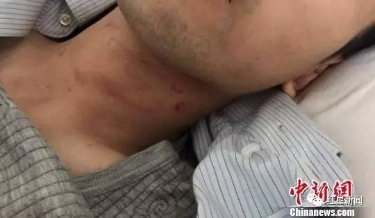 图为受伤的谢某