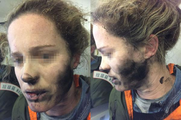 澳大利亚交通安全局公布照片显示，女乘客面部和颈部都有耳机爆炸后留下的灰。