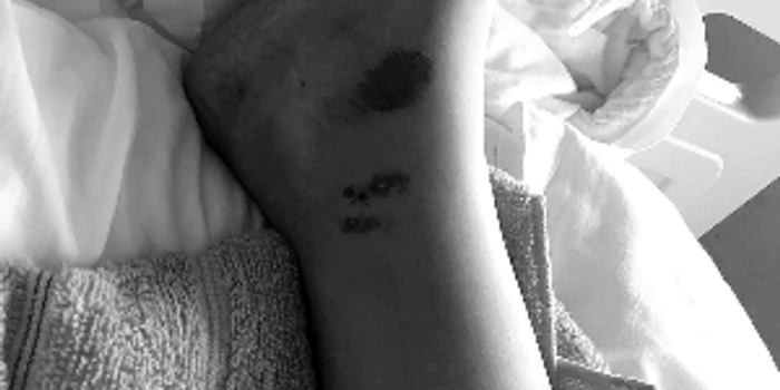 滴滴司机失误致乘客被碾骨折 司机称无力付医