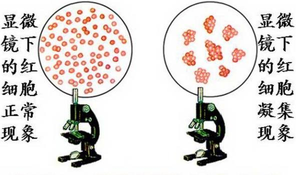 红细胞凝集（图片来源于网络）