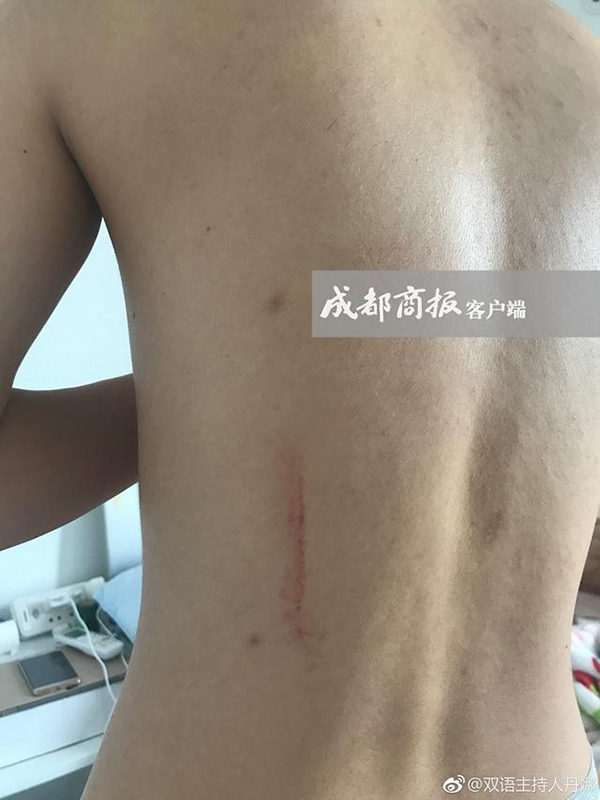 邓女士在微博发布的照片。