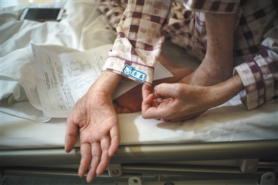 李真展示袖口的标贴。患病后，他的体重由130斤降到80斤。