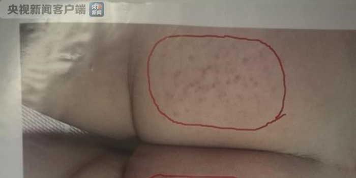 独家丨吉林四平红黄蓝幼儿园虐童案民事诉讼宣