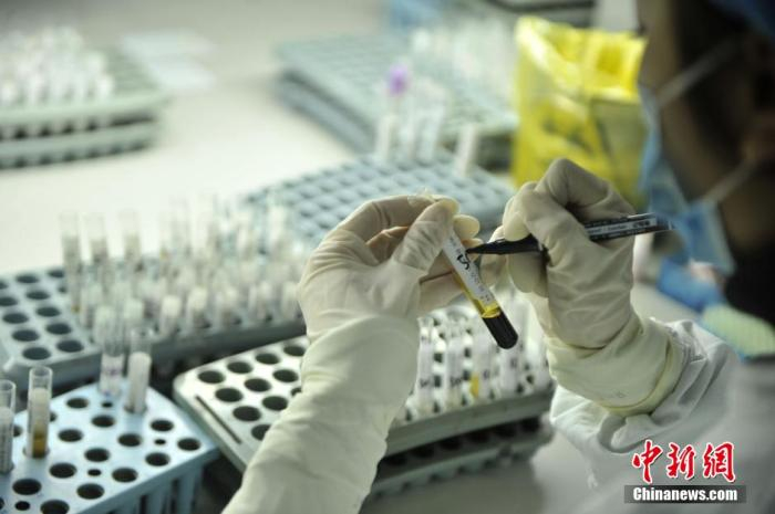 资料图：重庆新桥医院艾滋病筛查、确认实验室。图为医务人员标记样本。中新社记者 陈超 摄