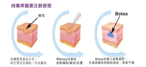 原理