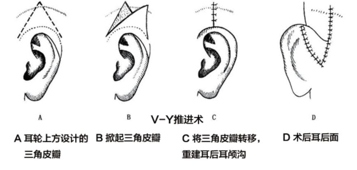 治疗