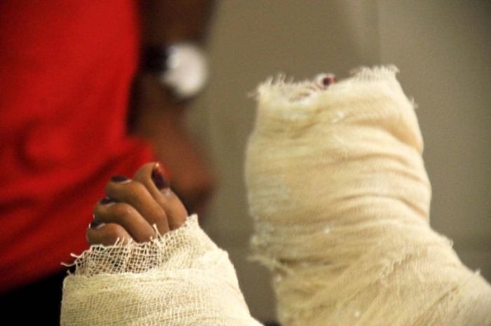  在医院的拉斐&nbsp; 图源：达卡论坛报