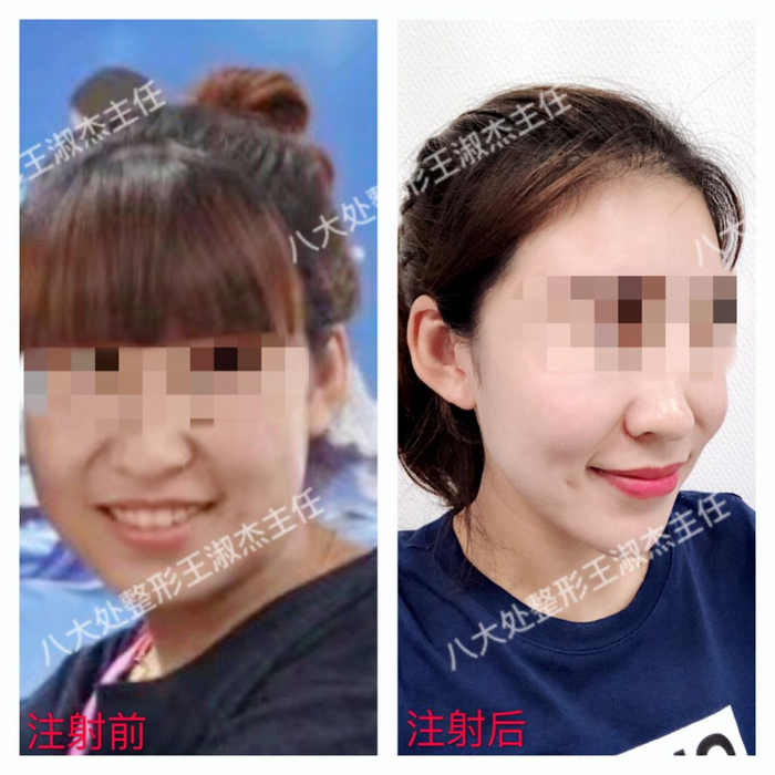效果
