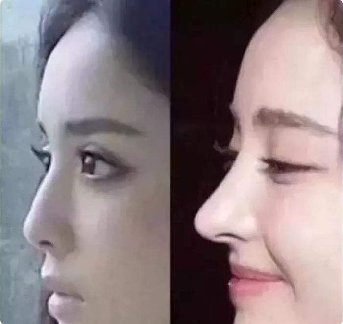 娜扎