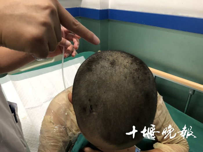 黄妈妈伤痕累累的头部