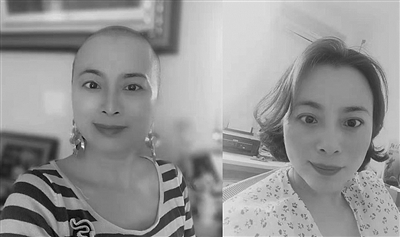  徐颖女士剃发前后的照片。 当事人提供