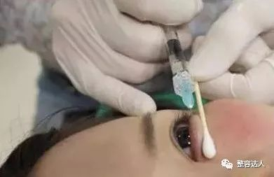 注射