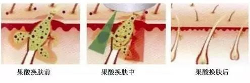 皮肤