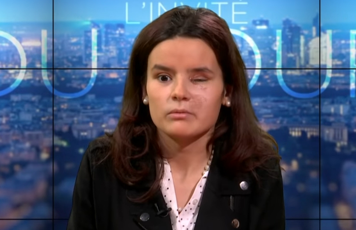  里格涅尔受伤后接受法国电视台TVL采访&nbsp; 视频截图