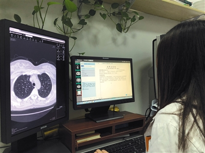 武警总医院医生用影像AI查看病人的CT影像。受访者供图