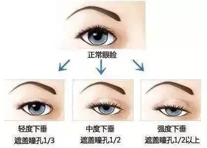 对比