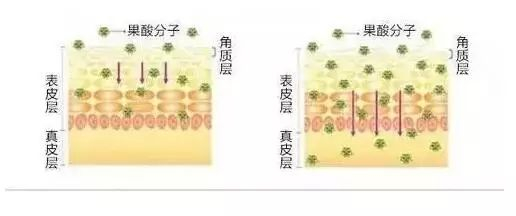 果酸换肤
