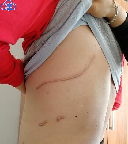 受害人马某龙伤口