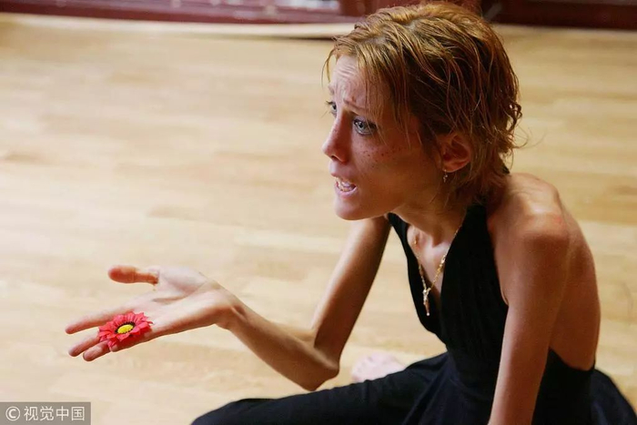 患厌食症的法国女模伊莎贝尔·卡罗。图片来自网络