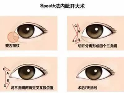 Speath法