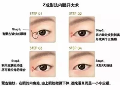 Z成形法