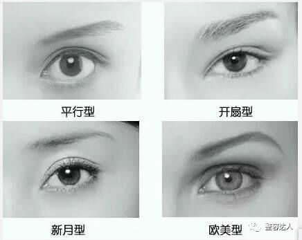常见的双眼皮类型
