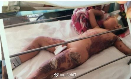 赵某旭住院时的伤情照片