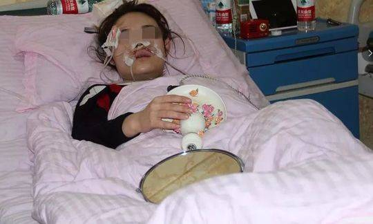 小艾受伤前后照片