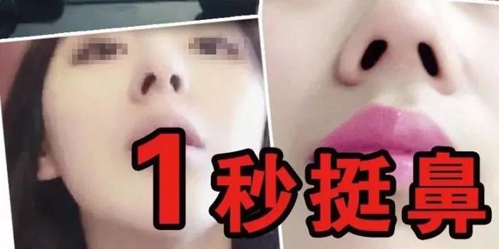 女子花14元网购 美鼻神器 却差点要了命 手机新浪网