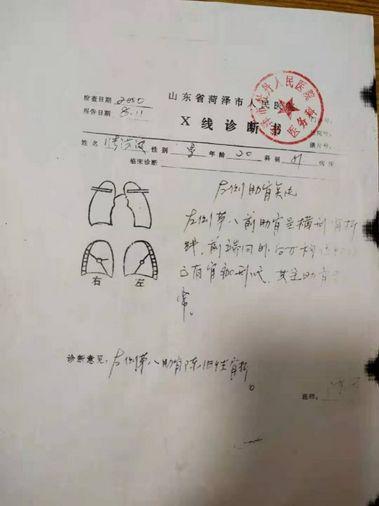 公安机关接到报警后，对此案也非常重视，因为这很有可能是一起抢劫银行的盗窃案，此事在当年引发当地媒体的关注。