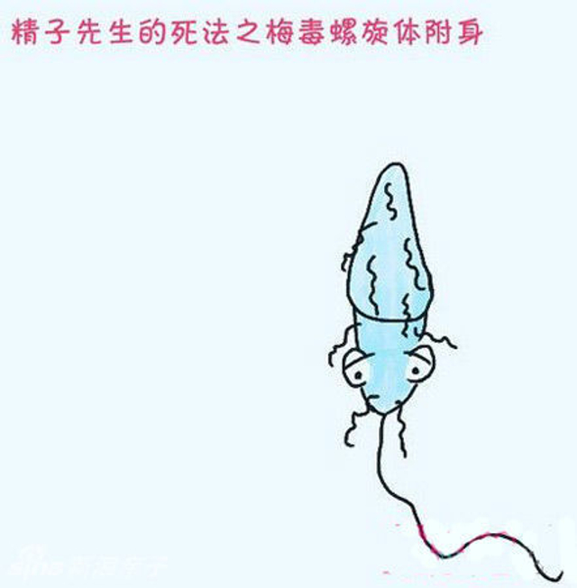 被梅毒螺旋体附身而死