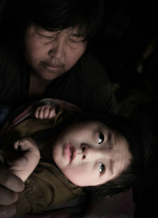 袁厉害正在照看一个脑瘫的孩子