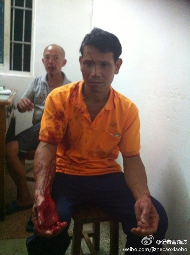 湖南临武城管被曝打死卖瓜商贩