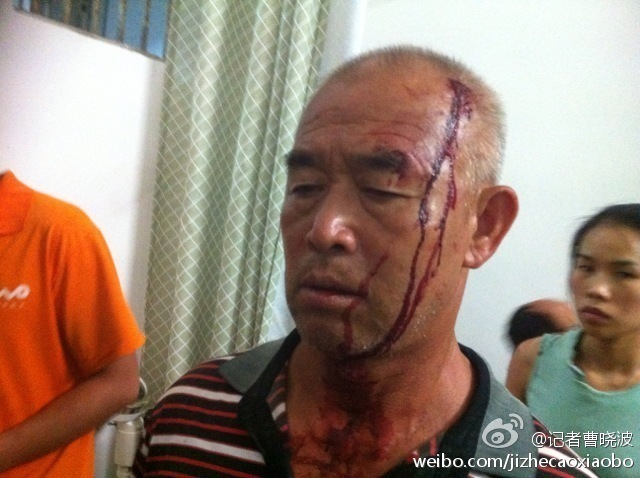 湖南临武城管被曝打死卖瓜商贩