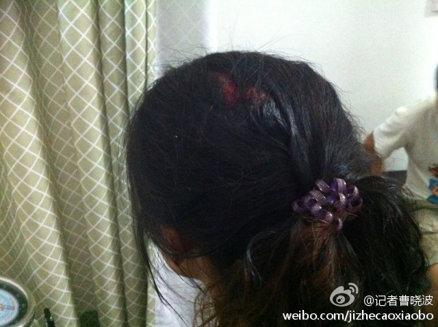 湖南临武城管被曝打死卖瓜商贩