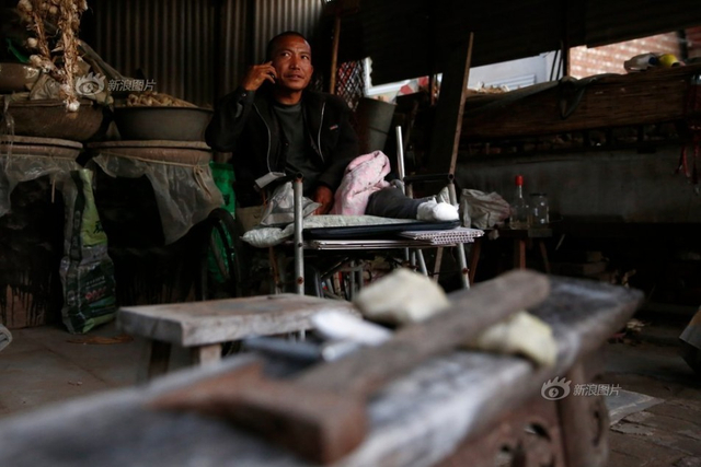 男子无钱手术在家中锯腿