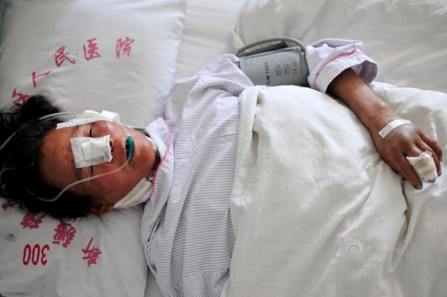 新疆发生狼群袭人事件 1人耳朵被咬掉