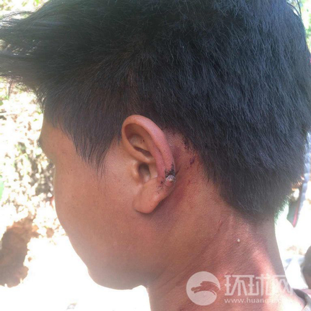 果敢同盟军与缅军交战照片