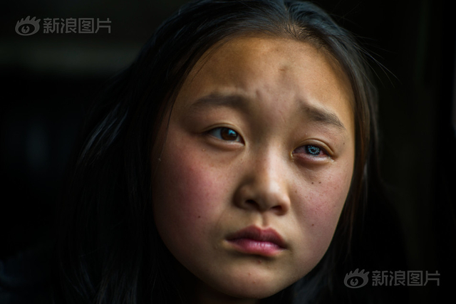 谁给我“眼睛”