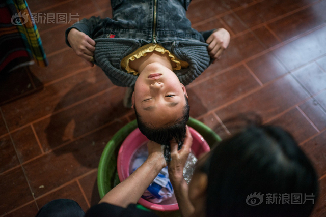 眼角膜是怎么移植给别人的 w640slw.jpg