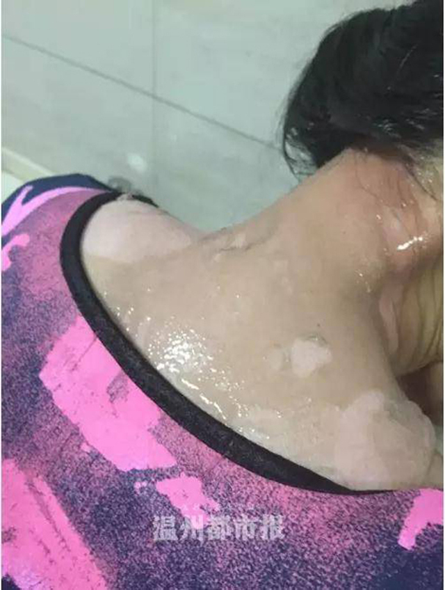 女子吃火锅加汤 服务员将热汤浇其头上