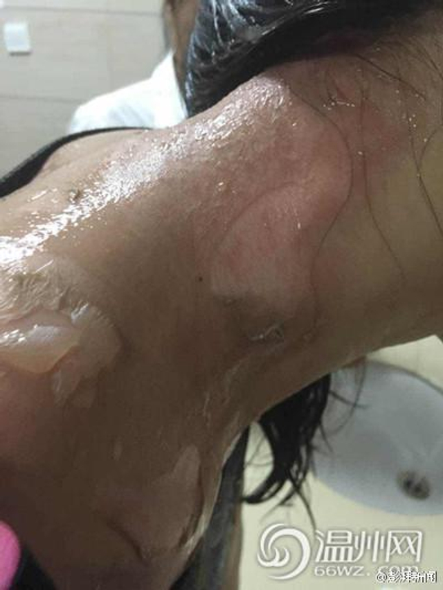 女子吃火锅加汤 服务员将热汤浇其头上