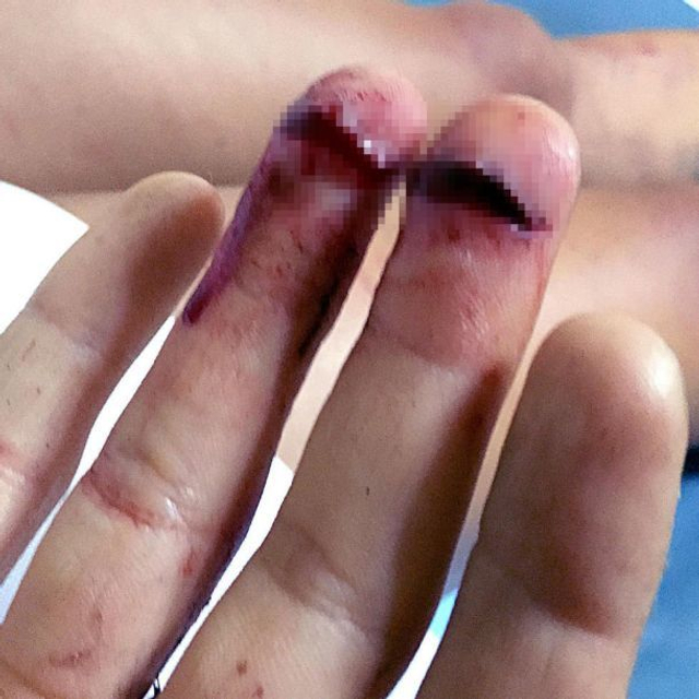 情侣旅游惨遇食人族 男被扒光衣服女遭轮奸