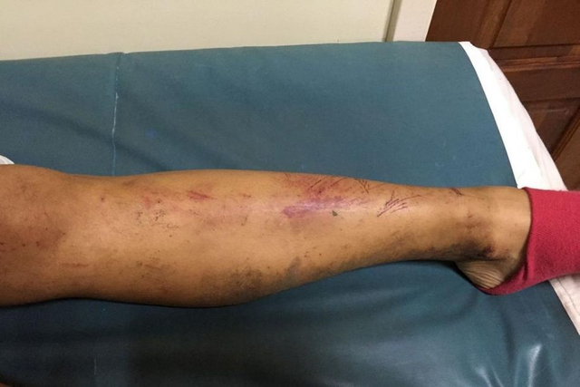 情侣旅游惨遇食人族 男被扒光衣服女遭轮奸