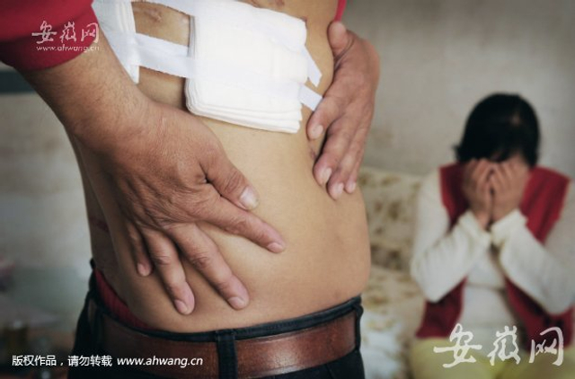 男子胸腔手术右肾失踪