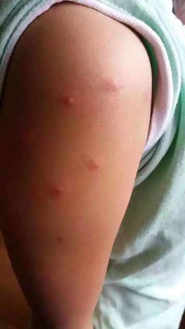 成都一小学疑现毒跑道 2000学生撤回老校区