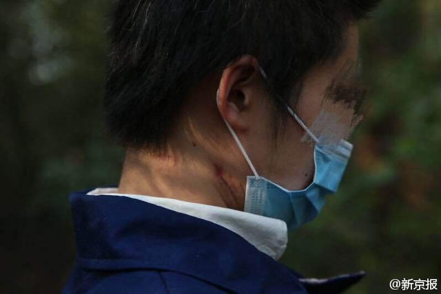 北京老虎袭人受伤女子首露面