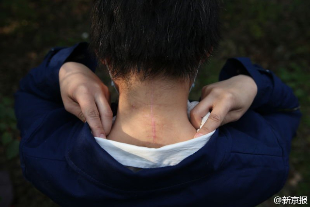 北京老虎袭人事件受伤女子首露面