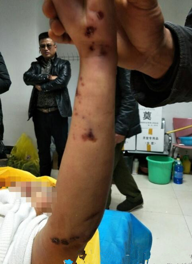 济南女大学生裸体坠楼身亡 尸体满身伤痕