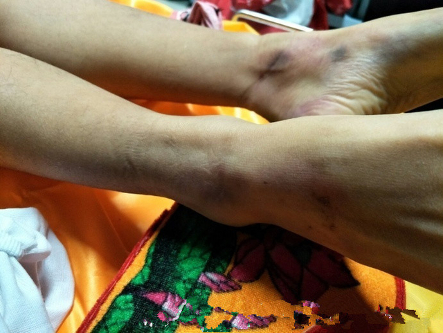 济南女大学生裸体坠楼身亡 尸体满身伤痕